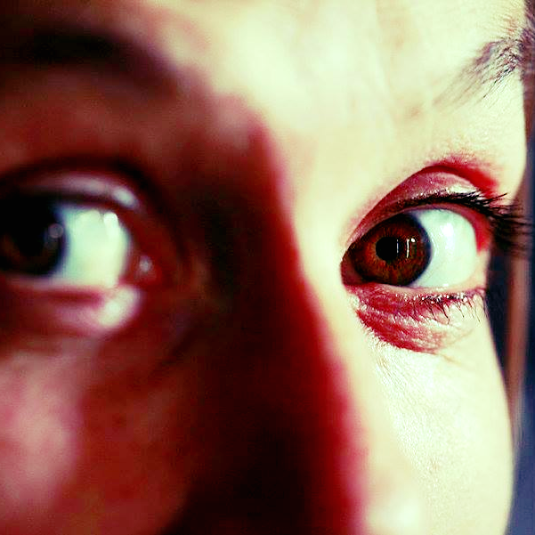 Mélancolie Motte Mélancolie Motte